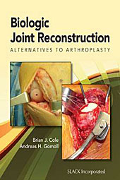 SIAECM Scaffale: Brian Cole and Andreas Gomoll: Biologic Joint Reconstruction  - Alternatives to Joint Arthroplasty