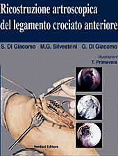 Ricostruzione Artroscopica del legamento crociato anteriore